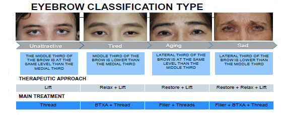 ijocs-Eyebrows