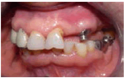 ijocs-23-114113-g013